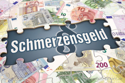 Für was bekommt man am meisten Schmerzensgeld? Die wichtigsten Fälle