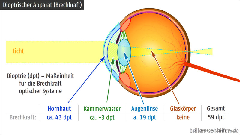 Ist 10 Dioptrien viel? Was du über Sehschwächen wissen solltest