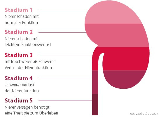 Ist Calcium schlecht für die Nieren?