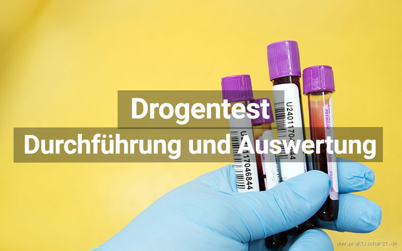 Kann man einen Drogentest umgehen? Alles, was du wissen musst