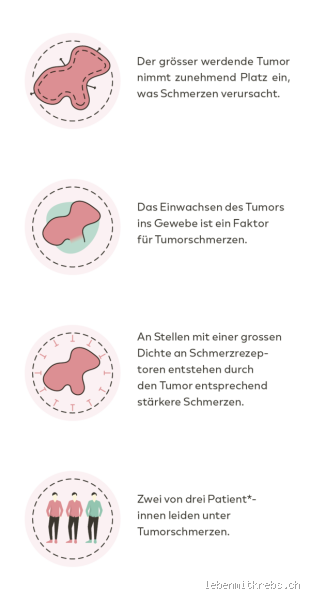 Können Tumorschmerzen kommen und gehen?