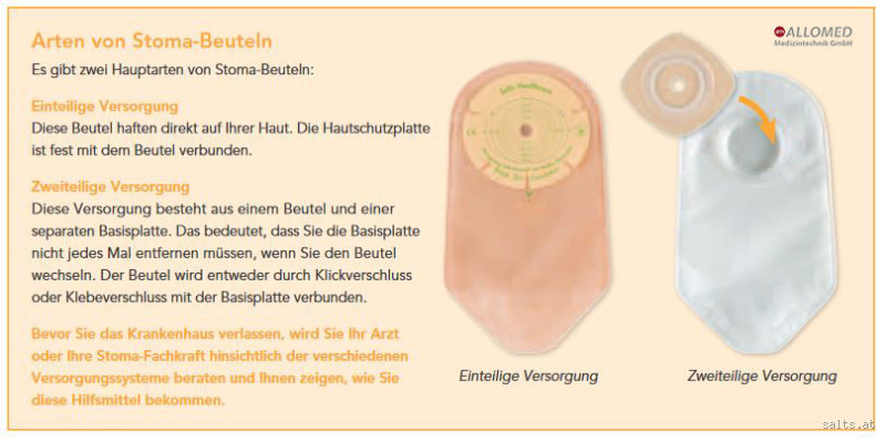 Warum platzt der Stomabeutel immer auf? Ursachen und Lösungen