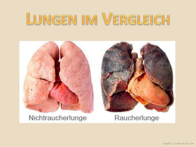 Was passiert, wenn man bei Lungenkrebs weiter raucht? Die erschreckenden Folgen