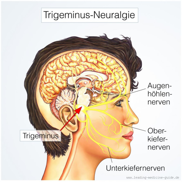 Welcher Mangel verursacht Nervenschmerzen? Die Ursachen und Lösungen