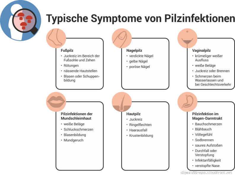 Wie fängt man sich eine Pilzinfektion ein? Erstaunliche Fakten und Tipps