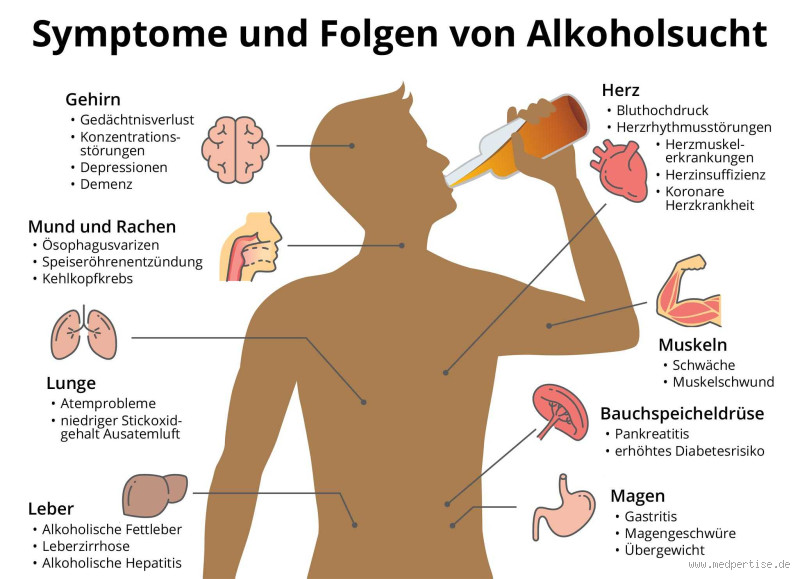 Wie macht sich eine Alkoholsucht bemerkbar? Anzeichen und Symptome erkennen