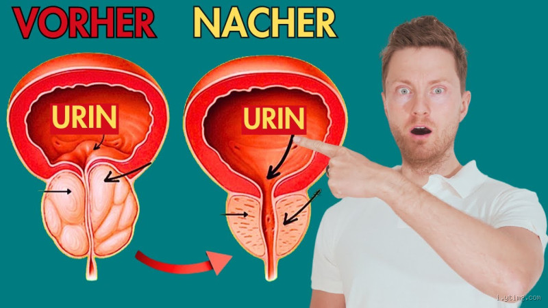 Wie trainiert man die Prostata? Tipps und Übungen für die Gesundheit