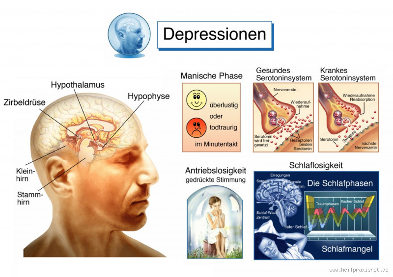 Was fehlt bei Depressionen im Gehirn? Ein tiefer Einblick in die Ursachen