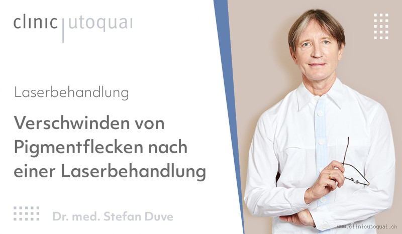 Wann verschwinden Pigmentflecken nach einer Laserbehandlung?