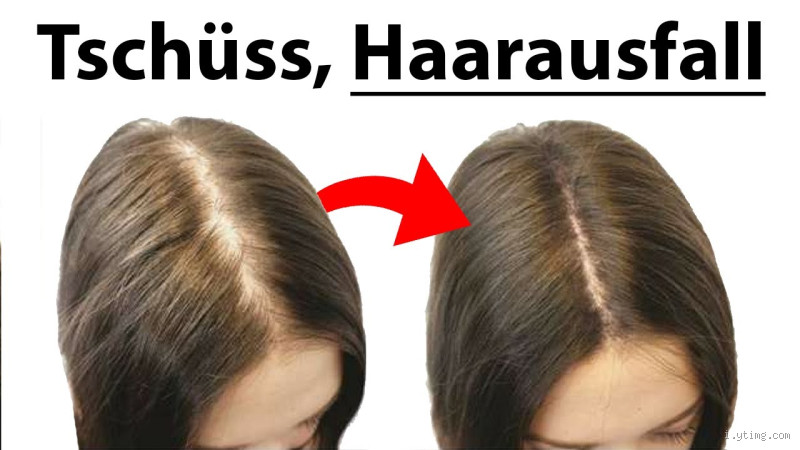 Was stoppt sofort Haarausfall? Effektive Lösungen und Tipps
