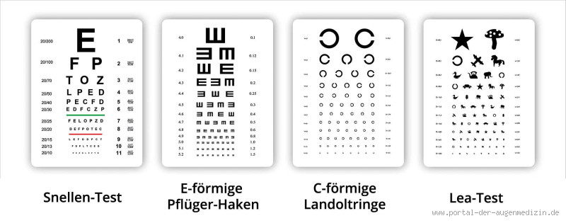 Was kann einen Sehtest stören? Wichtige Faktoren, die du kennen musst