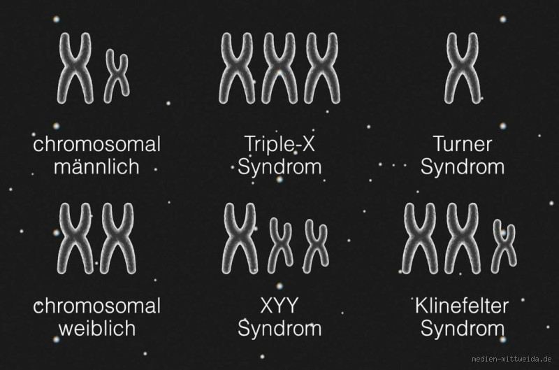 Wie heißt das dritte biologische Geschlecht? Entdecke die Wahrheit dahinter